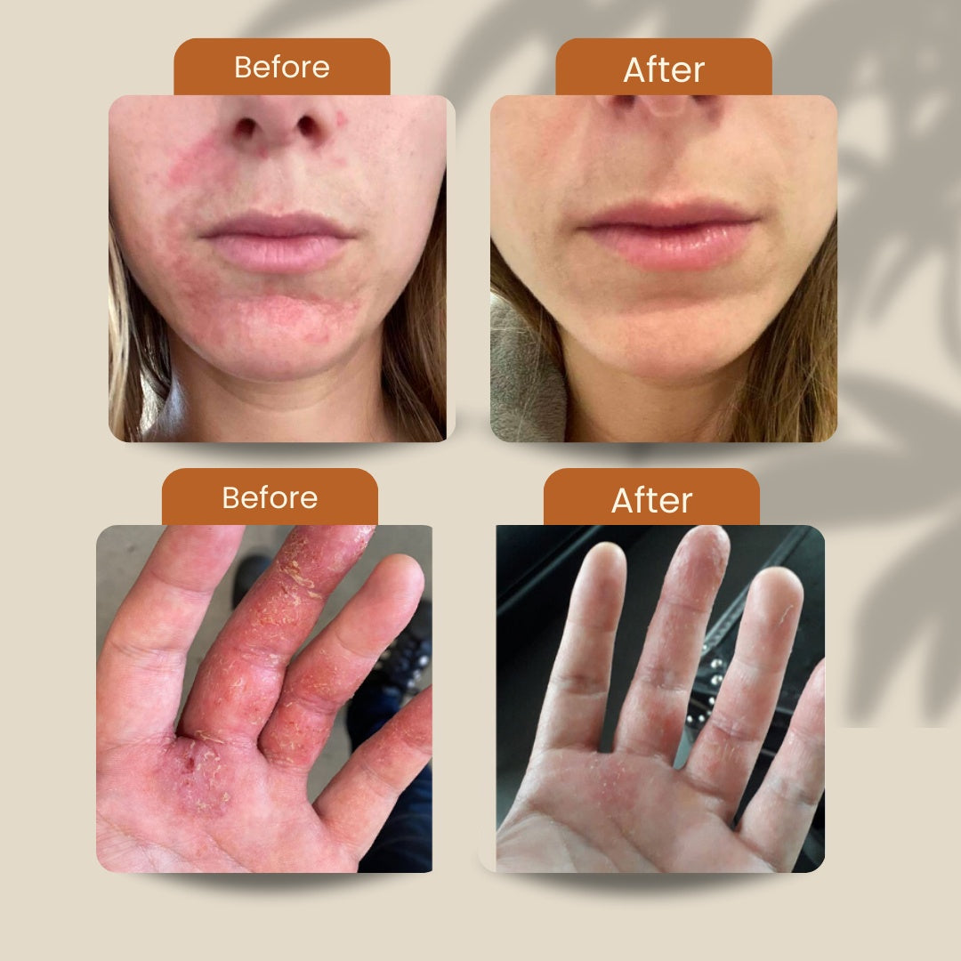 Koaka Skin Rescue Balm 55g